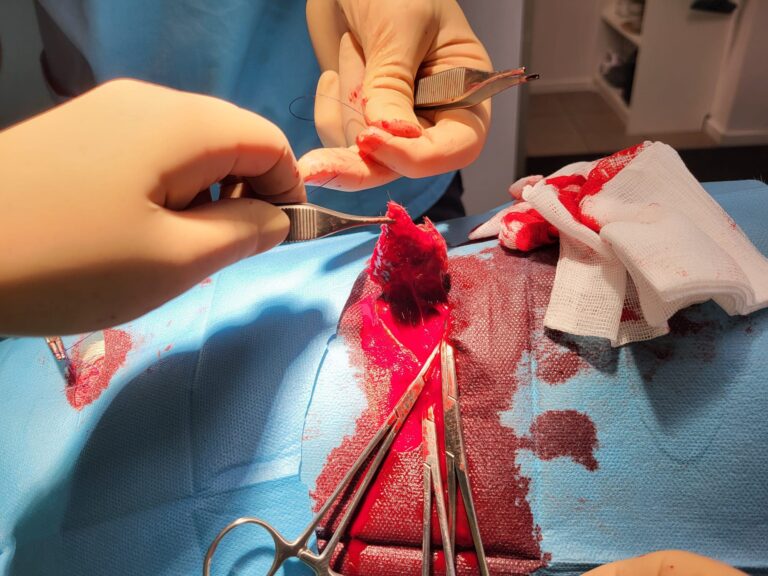 Chirurgie